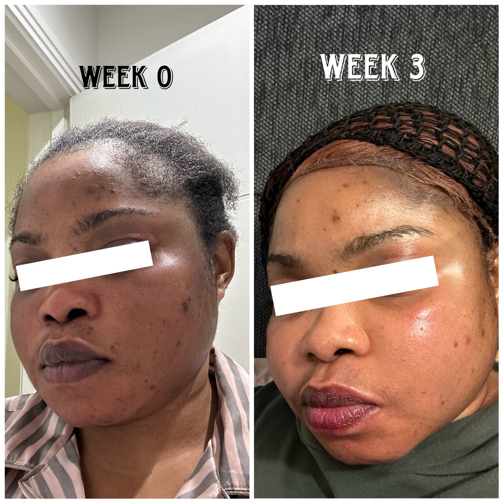 Glow Verse Snow Glow Whitening Face cream 30g