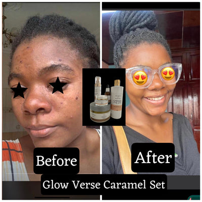 Glow Verse Caramel Full Set